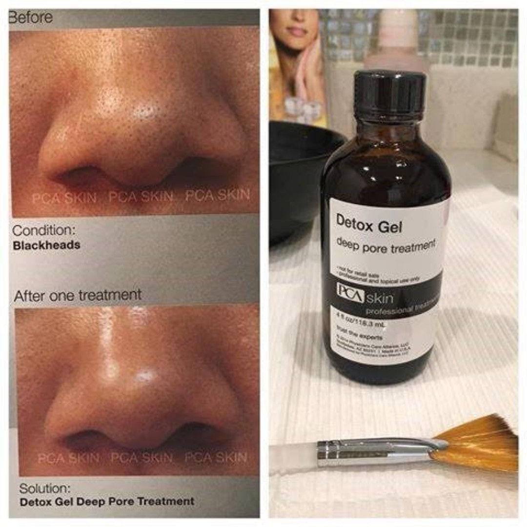 pca –deep pore cleansing facial