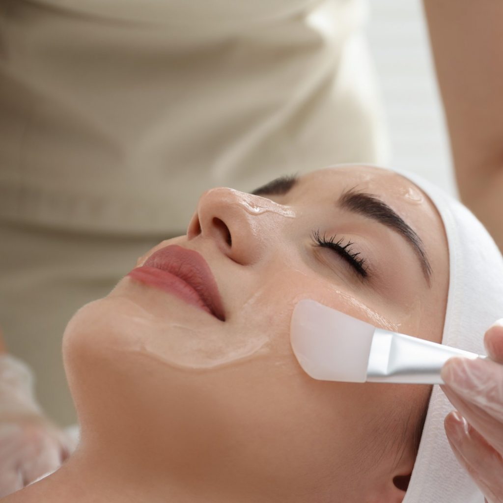 chemical peels