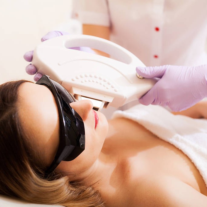 laser hair removal