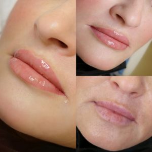lip1