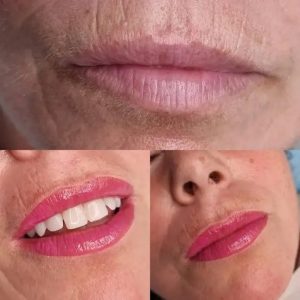 lip10