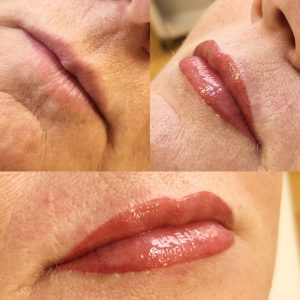 lip3