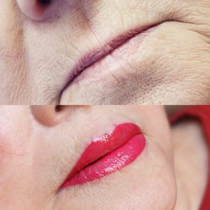 lip7