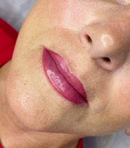 lip8