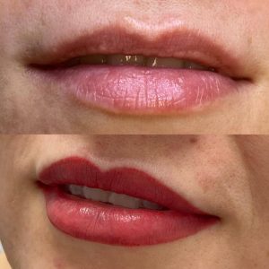 lip9